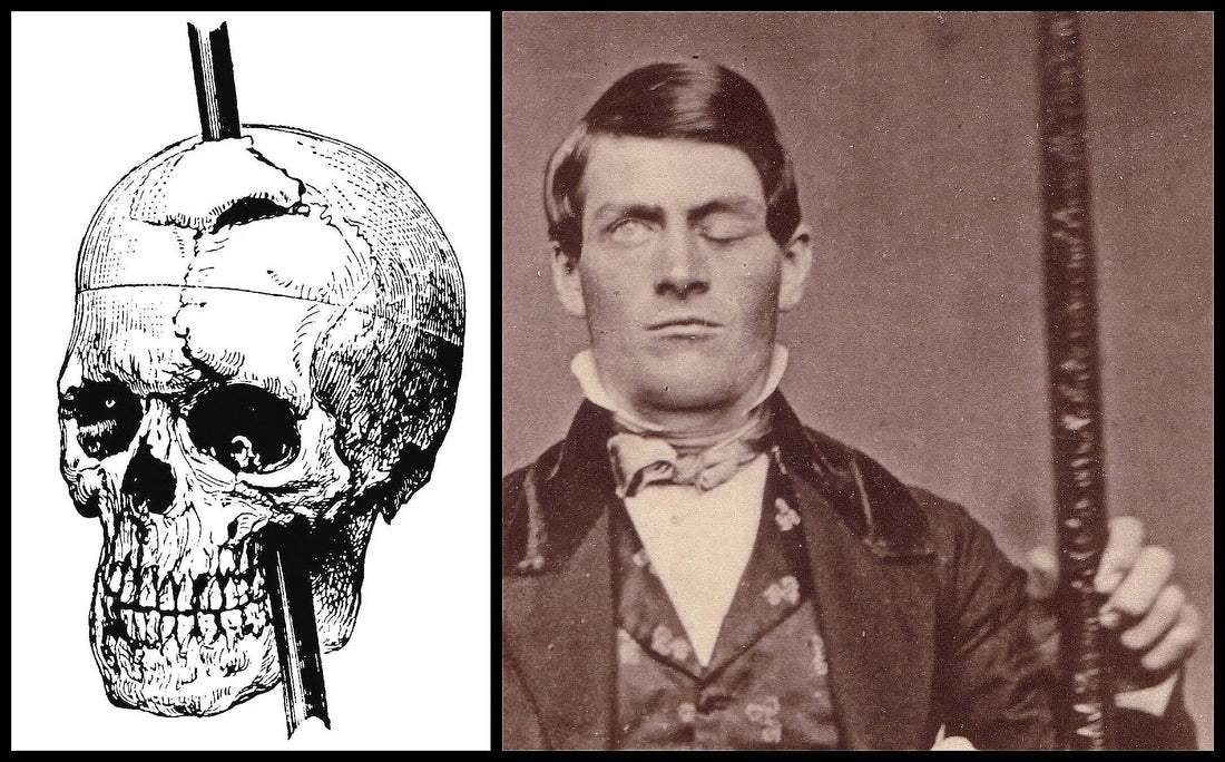 Phineas Gage